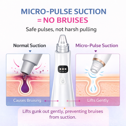 Velithra™ Blackhead Vacuum