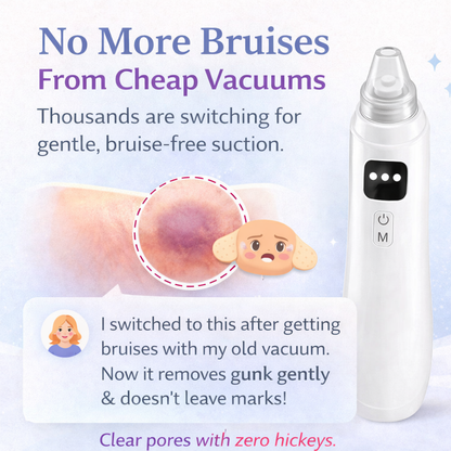 Velithra™ Blackhead Vacuum
